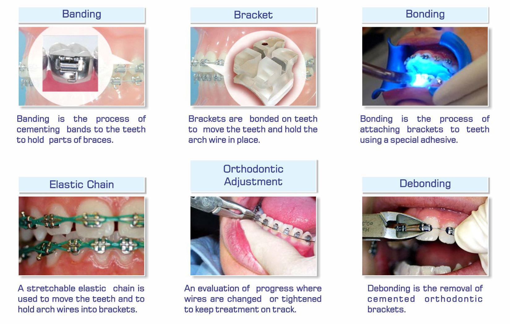 full mouth rehabilitation