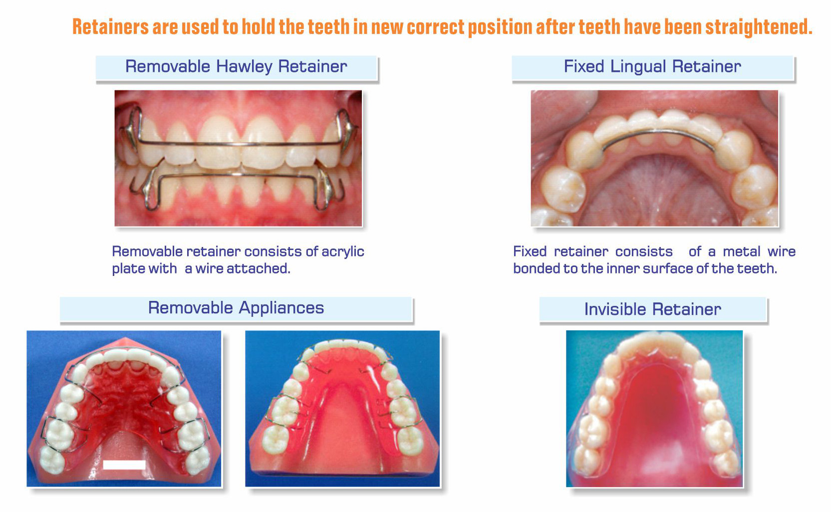 full mouth rehabilitation